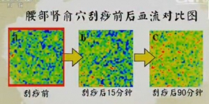 健康之路20170211王莹莹《手到病除（中）》颈痛、腰痛、腿麻
