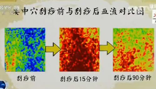 健康之路20170211王莹莹《手到病除(中)》颈痛、腰痛、腿麻