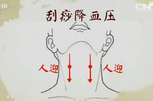 健康之路20170212王莹莹《手到病除(下)》刮痧禁忌