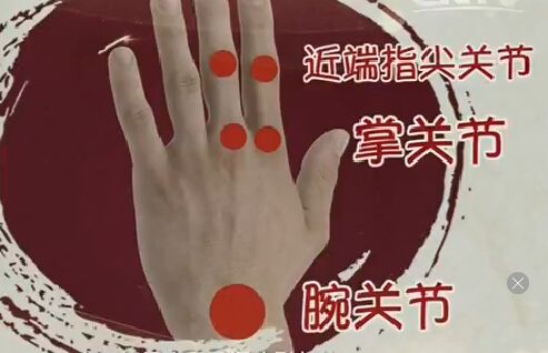 健康之路20170220王振刚《有种痛叫风湿(上)》