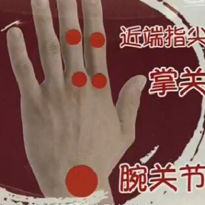 健康之路20170220王振刚《有种痛叫风湿（上）》