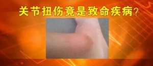 养生堂20170316汪芳《警惕要命的腿肿 》单腿肿、双腿肿，哪种更凶险？