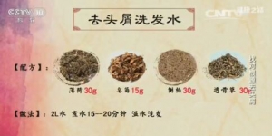 健康之路20170504孙丽蕴《找对根源去头屑》