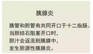 健康之路20170601胡海《胆结石的祸与惑》