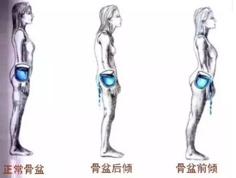 健康之路20171029《骨正才能保健康(四)》骨盆矫正