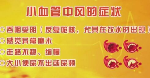 20190108养生堂:李小刚《密布丛生的“血疙瘩”》小血管中风