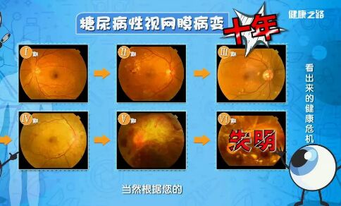 20190227健康之路视频笔记《看出来的健康危机》