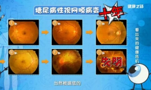 20190227健康之路视频笔记《看出来的健康危机》