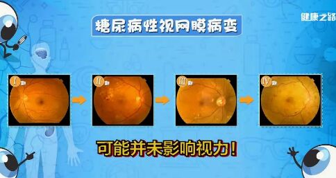 20190227健康之路视频笔记《看出来的健康危机》