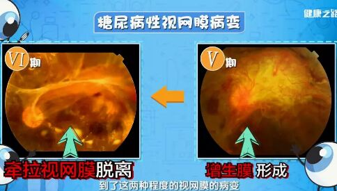 20190227健康之路视频笔记《看出来的健康危机》