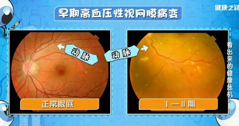 20190227健康之路视频笔记《看出来的健康危机》