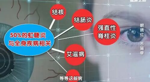 20190228健康之路视频笔记《眼睛红 不简单》