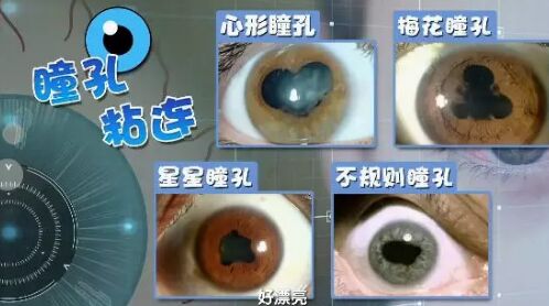 20190228健康之路视频笔记《眼睛红 不简单》