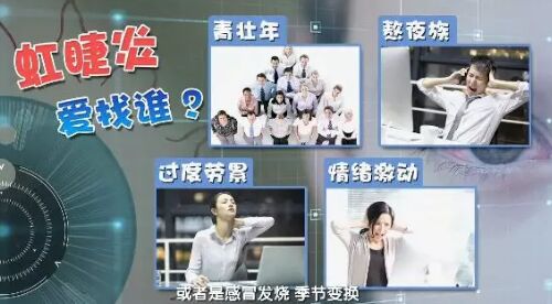 20190228健康之路视频笔记《眼睛红 不简单》