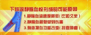 20190308养生堂视频笔记:《从腿肿“顺藤摸瓜”找血栓》