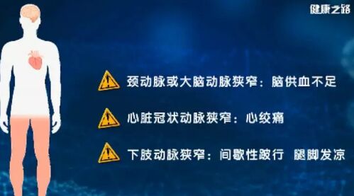 健康之路20190515尿酸,动脉粥样硬化斑块,炎症,血糖,高嘌呤食物