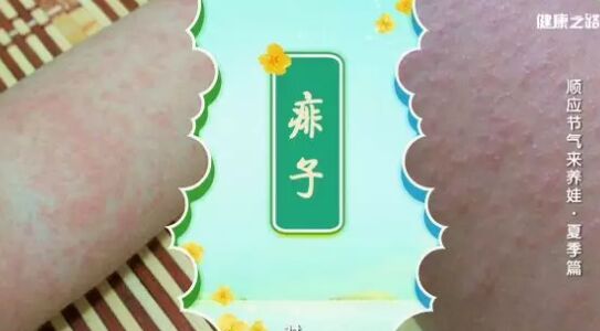 20190714健康之路视频和笔记:王波,厌食,腹泻,磨牙,痱子,碧玉散