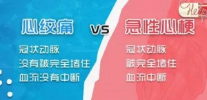 20190927健康之路视频笔记:许俊堂,硝酸甘油如何服用才有效?