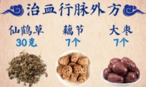 20221206养生堂,曹炜,血瘀,活血通络,痹证,治血行脉处方